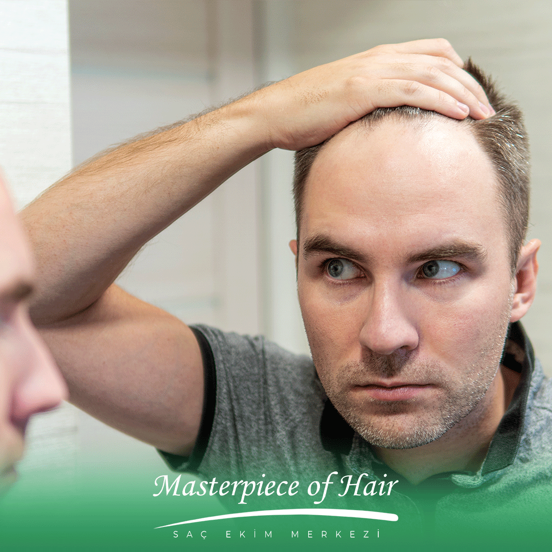 saç-dökülme-sebepleri