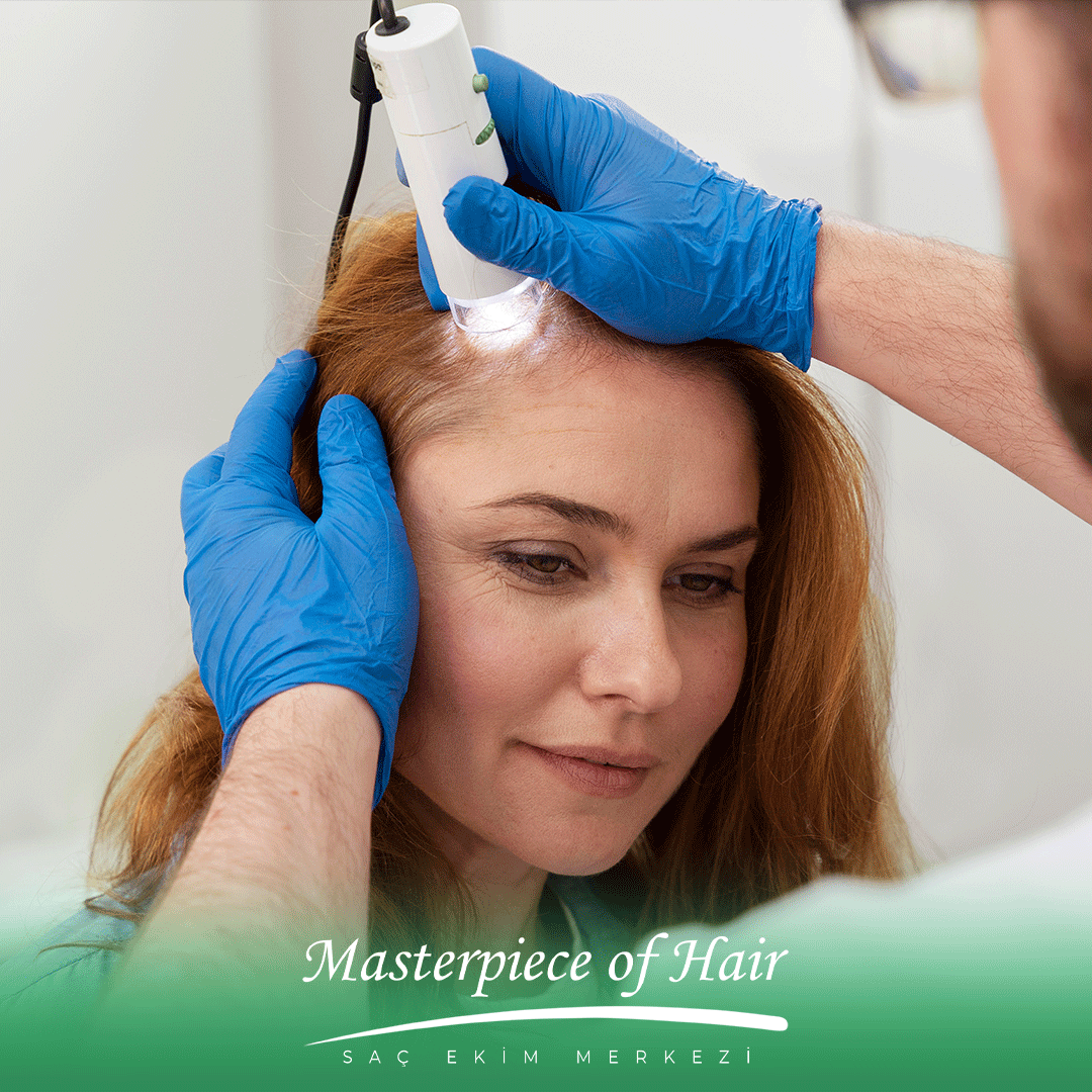 saç-dökülme-tedavileri