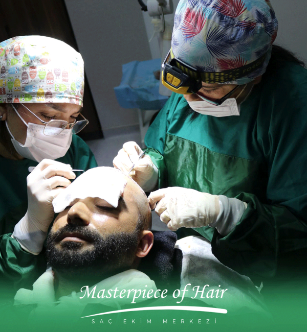 saç-ekimi-aşaması